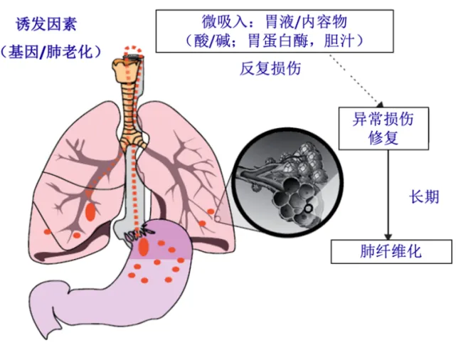 Research Tips | A one-stop solution for preclinical animal research on pulmonary fibrosis, empowering scientific exploration and innovation