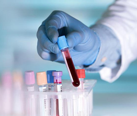 Pulse oximeter - a reliable tool for accurately solving the problem of non-invasive and continuous monitoring of blood oxygen saturation in small animals