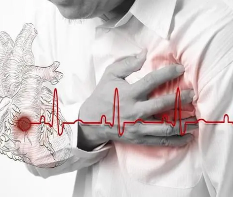 Literature Interpretation | Good news for myocardial infarction patients with IF=10.7!A domestic team discovered a new target for inhibiting ischemia-reperfusion injury