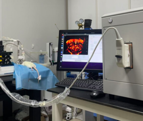 Technical Analysis | Brain Function Ultrasound Imaging System: A New Key to Unlocking the Mysteries of Brain Science!