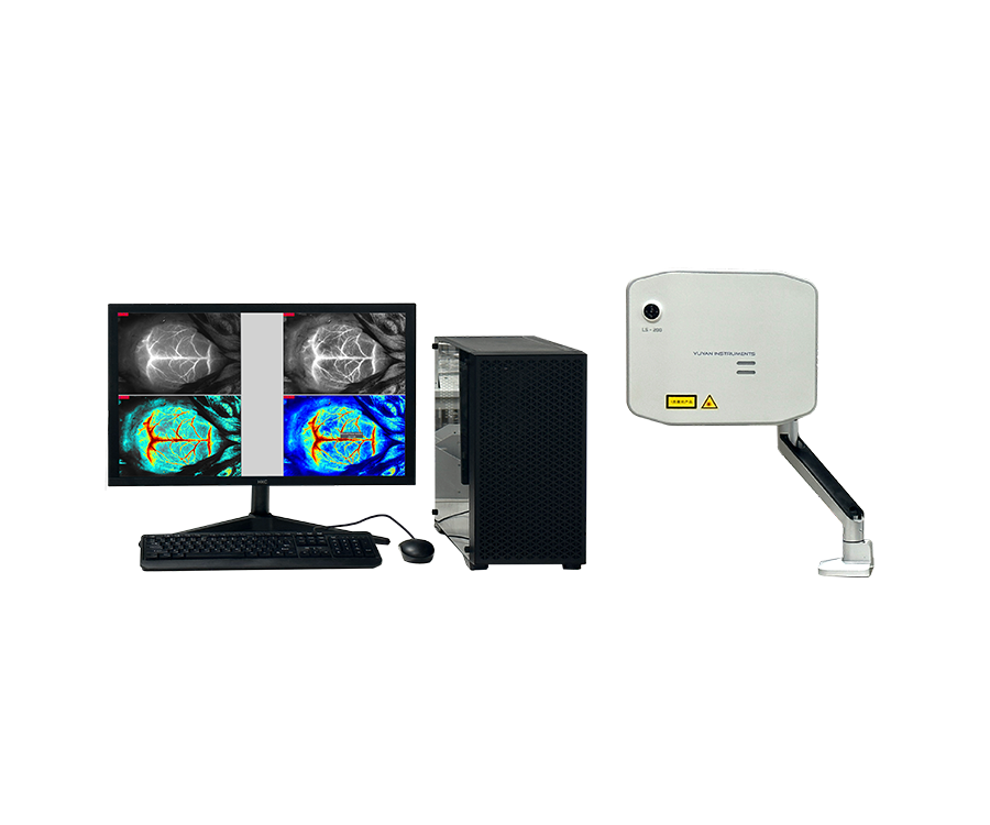 Laser speckle blood flow imager